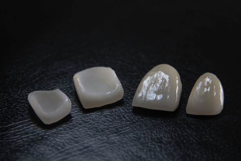 small dental veneers displayed in Wetherill Park