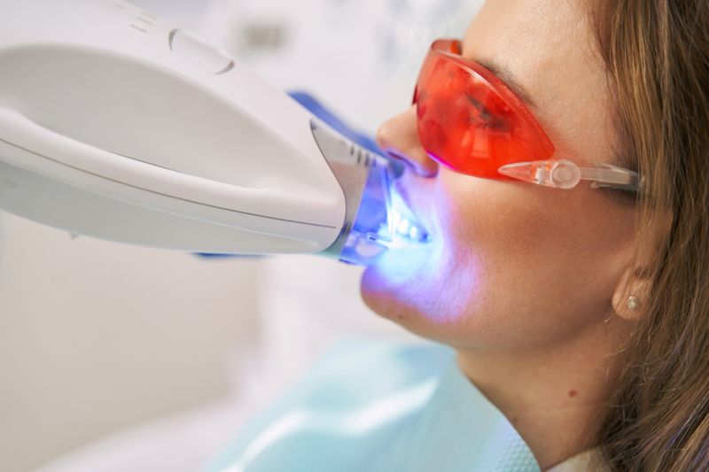 Teeth Whitening in Wetherill Park – Brighten Your Smile Safely at Dr Raymond Platon and Associates