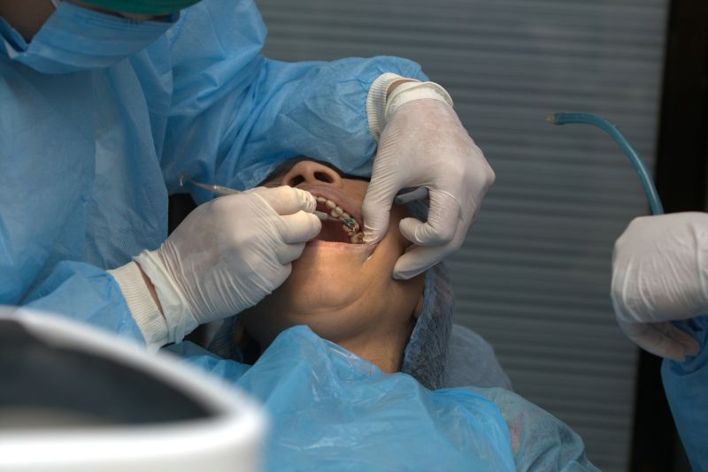 Dental filling procedure at Wetherill Park dental clinic