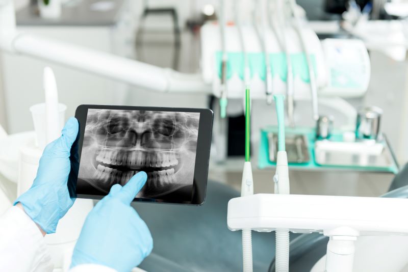 Dental X-ray to diagnose tooth pain at Wetherill Park dental clinic