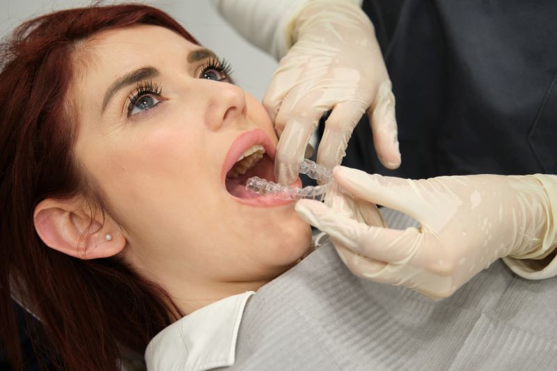 Orthodontic adjustment during Invisalign® in Wetherill Park