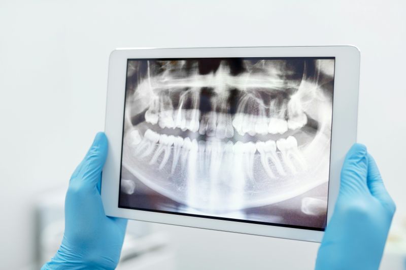 Root canal Wetherill Park – X-ray with dentist