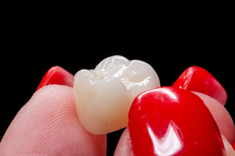 Dental crown in Wetherill Park used to restore damaged tooth