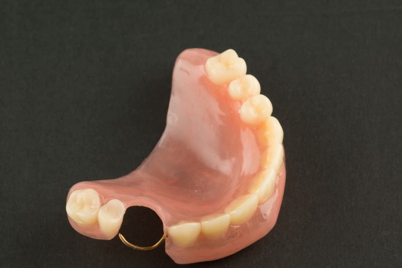 acrylic dental prosthesis with metal retaining elements on black background