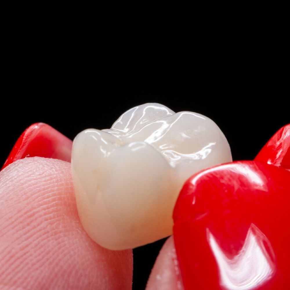 service-crowns-dentist-wetherill-park Close-up of a porcelain dental crown held between fingers – dental crown in Wetherill Park.