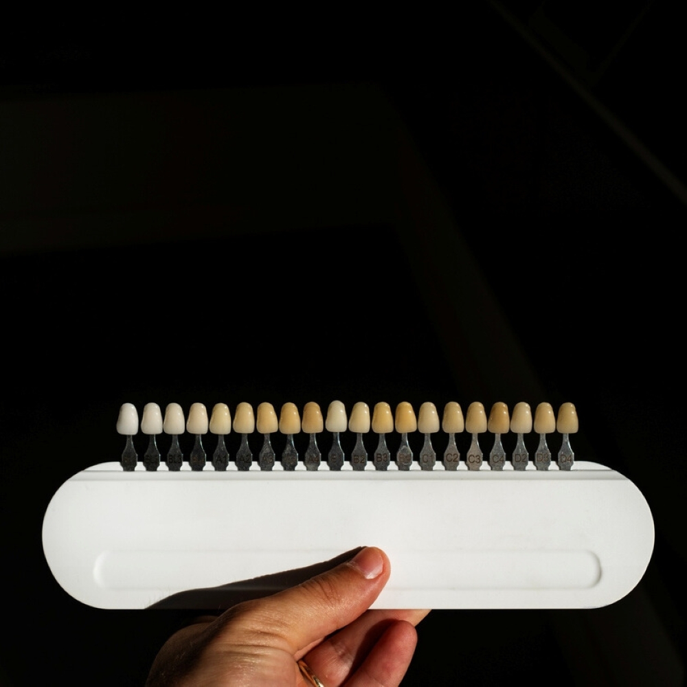 service-smile-design-dentist-wetherill-park Shade guide for teeth colour selection – cosmetic dentistry tool at Wetherill Park dental clinic.
