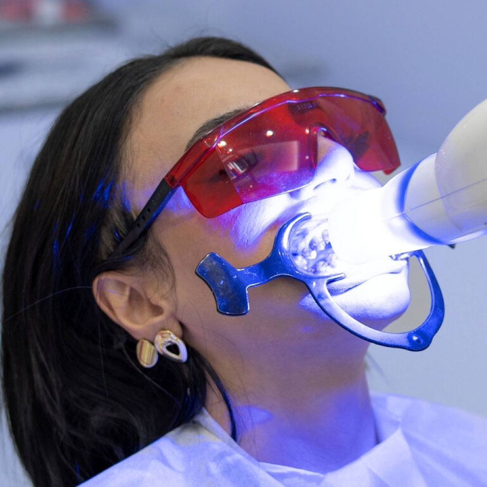 service-teeth-whitening-dentist-wetherill-park Patient undergoing professional teeth whitening treatment with LED light activation – Wetherill Park dental clinic.