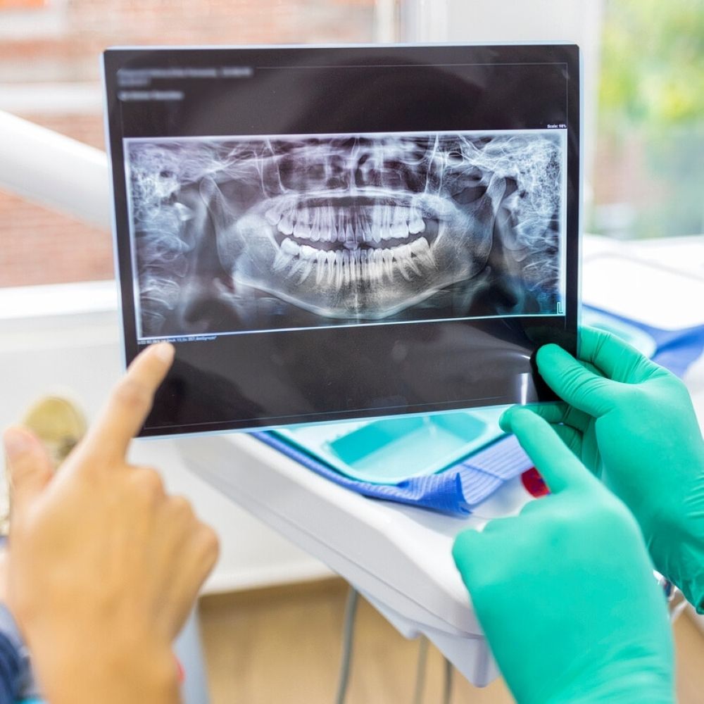 service-surgical-extractions-dentist-wetherill-park Surgical Extractions Wetherill Park – dentist reviewing X-ray with patient.