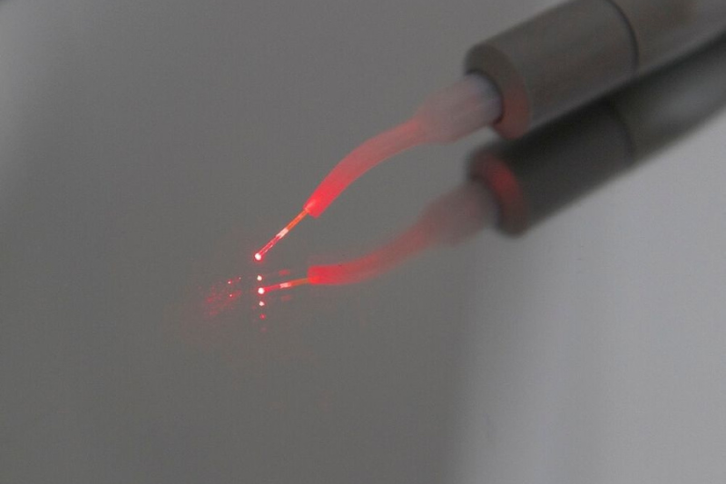 Dental Laser Treatment in Wetherill Park – Advanced, Gentle & Precise Dental Care