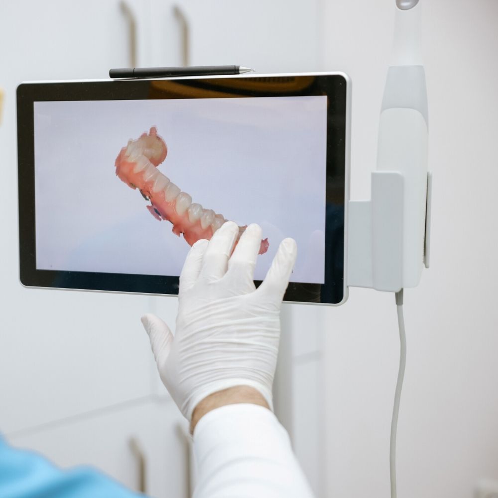 Free Orthodontic Consultation – Digital teeth scan at Dr Raymond Platon and Associates Wetherill Park