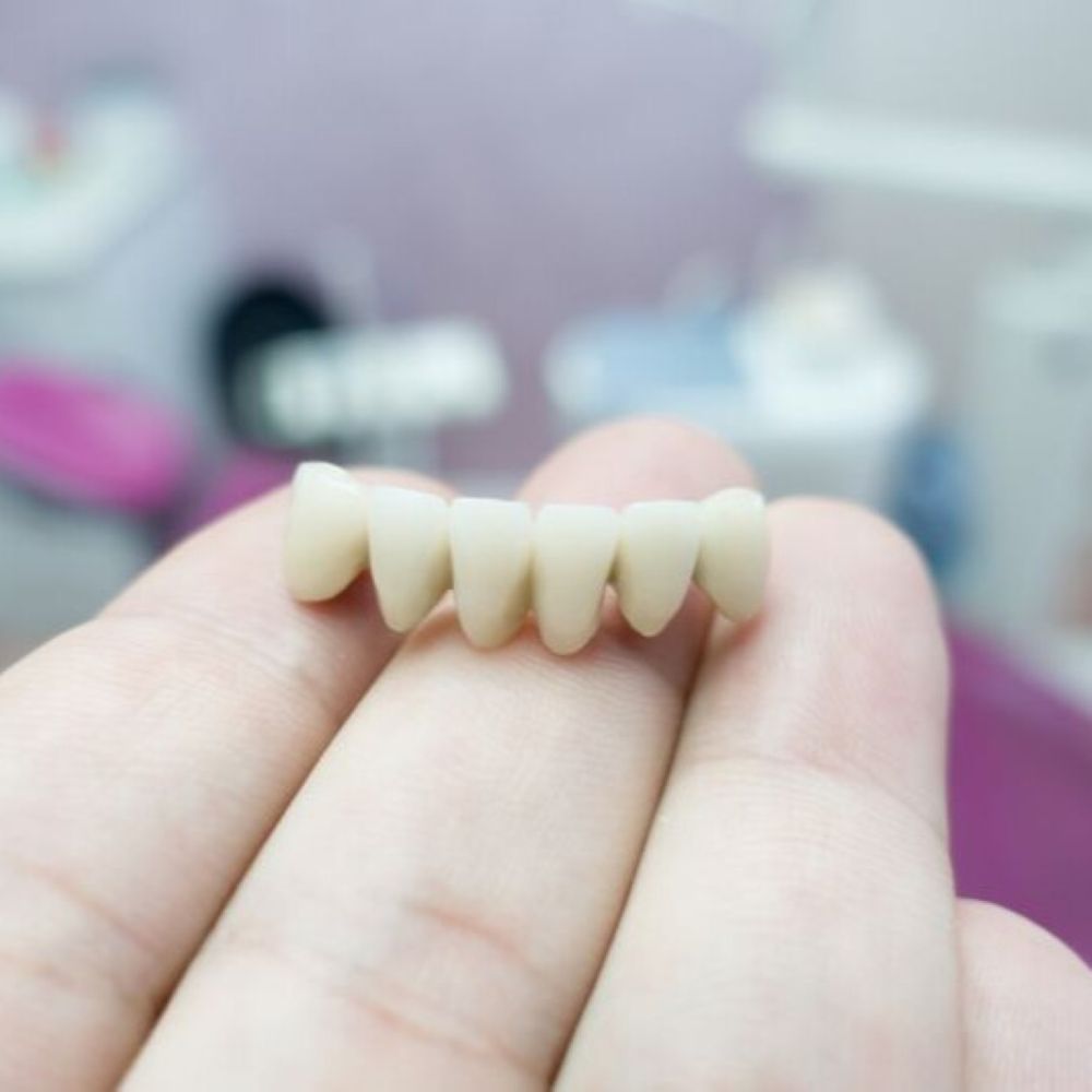 Close-up of a hand holding a porcelain dental bridge – dental bridges in Wetherill Park.
