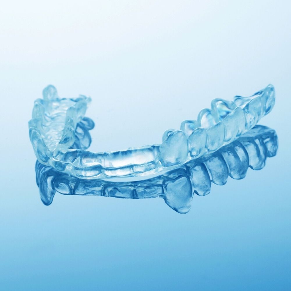 Custom night guard in Wetherill Park – clear dental guard for teeth grinding protection.