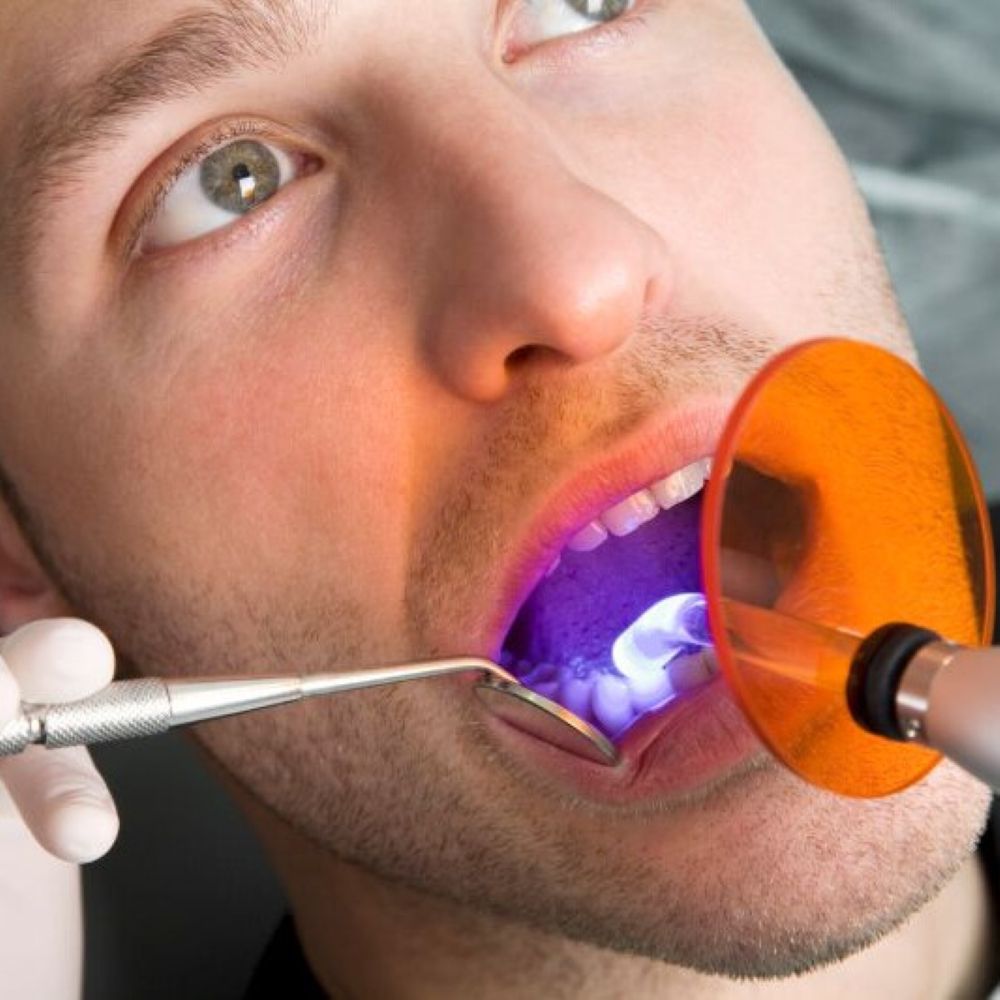 Male patient receiving tooth-coloured fillings in Wetherill Park at Dr Raymond Platon & Associates.