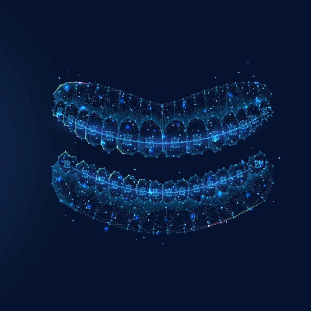 Digital wireframe illustration of upper and lower teeth with orthodontic braces — representing advanced orthodontic treatment and smile alignment in Wetherill Park.