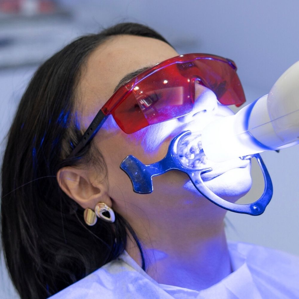 Patient undergoing professional teeth whitening treatment with LED light activation – Wetherill Park dental clinic.