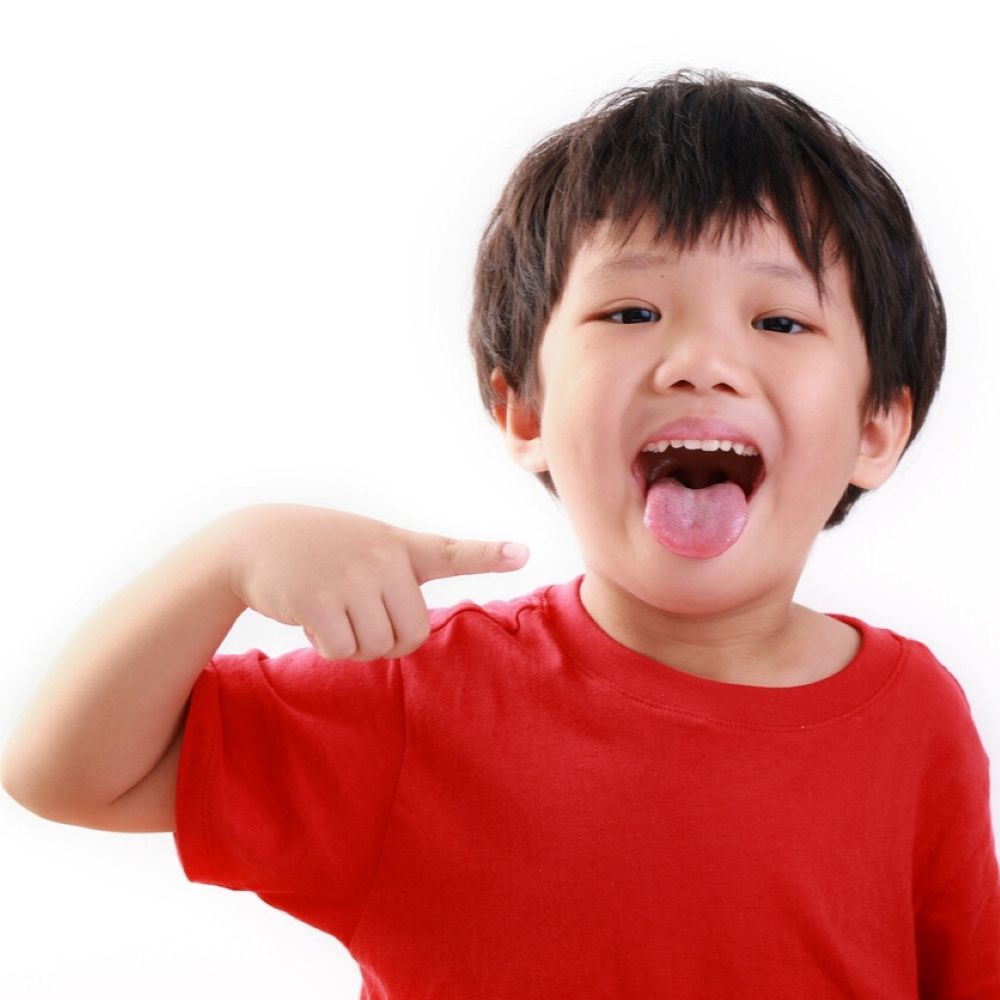 Child showing tongue – Laser Frenectomy Wetherill Park.