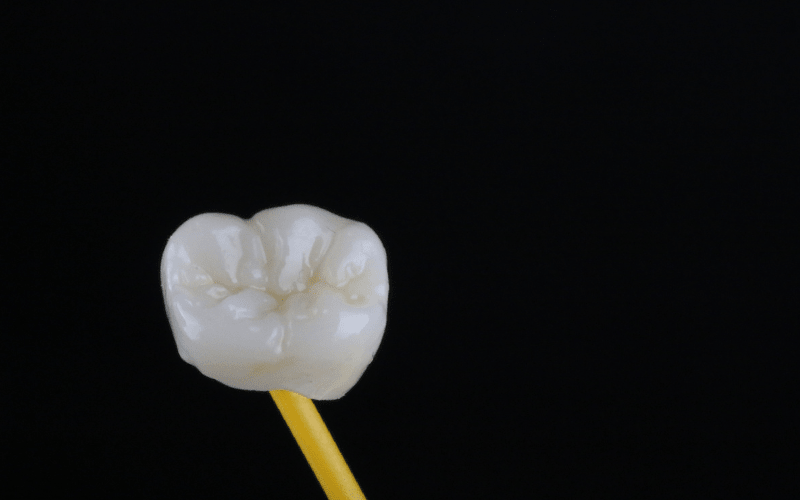 Lost dental crown removed from tooth causing pain when biting in Wetherill Park