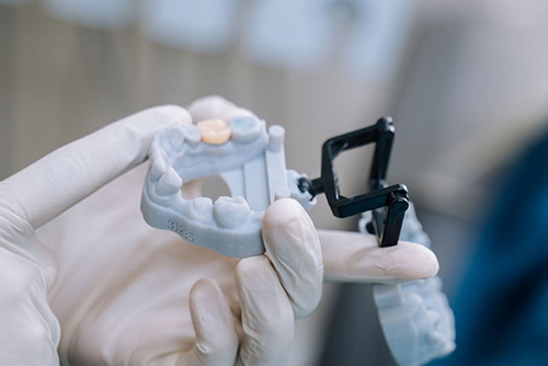 Restorative dentistry treatment model used during patient care in Wetherill Park