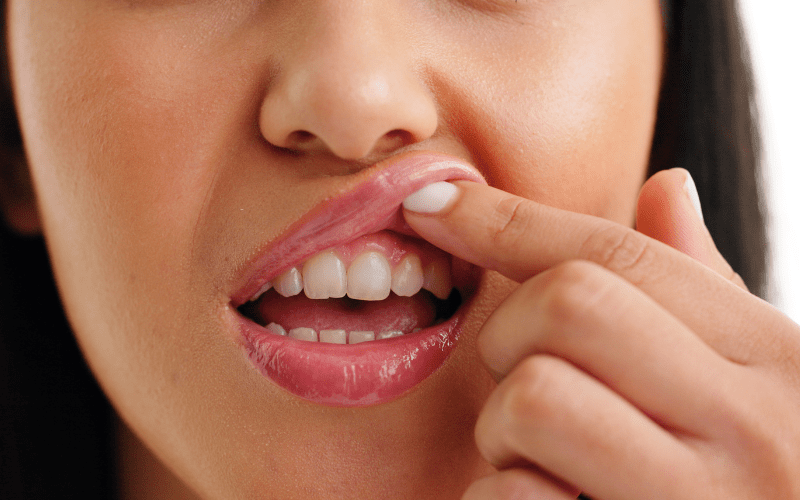 Why Do Gums Feel Sore or Tender Even Without Bleeding in Wetherill Park?