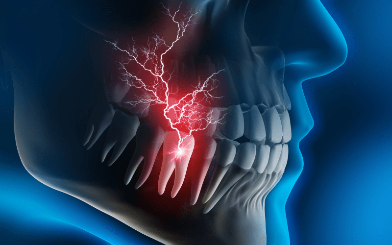 Illustration showing tooth nerve inflammation causing tooth pain when biting in Wetherill Park
