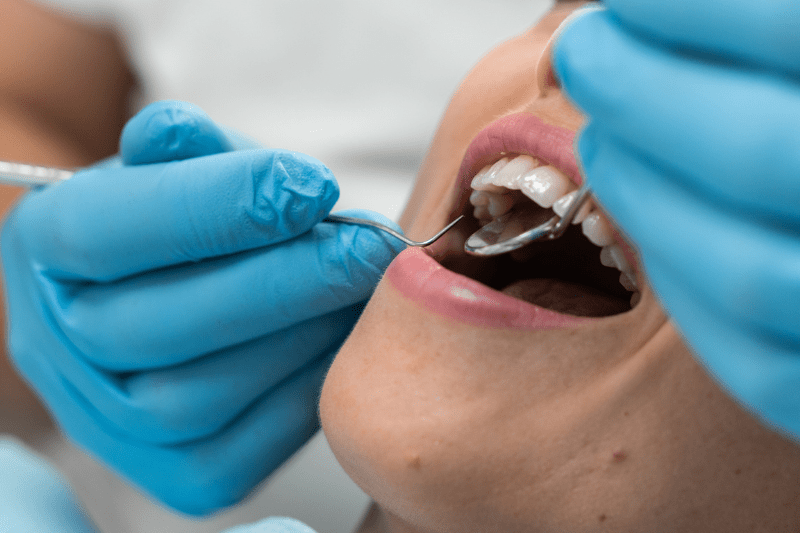 Dental exam in Wetherill Park showing a dentist assessing teeth during a routine check-up