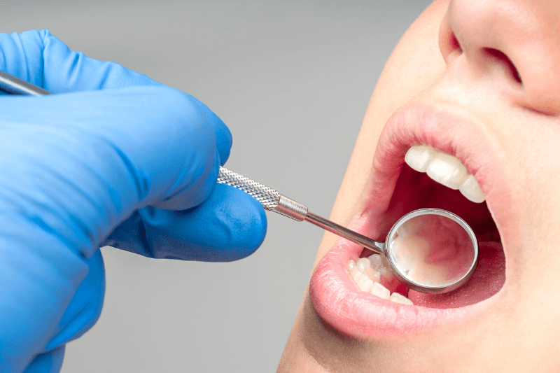 Dental examination showing swollen gums and gum inflammation in Wetherill Park
