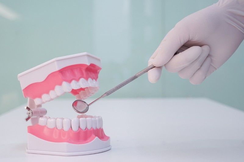 Gum disease causing loose tooth in adults Wetherill Park dental model