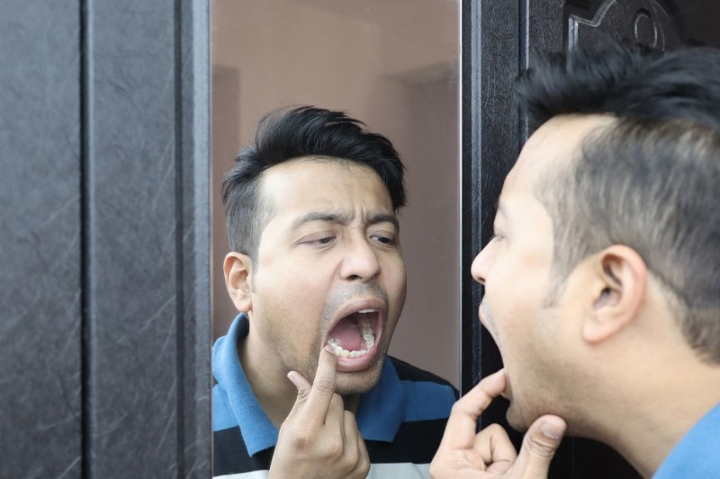 Loose Tooth in Adults in Wetherill Park: Causes, When to Worry and What to Do