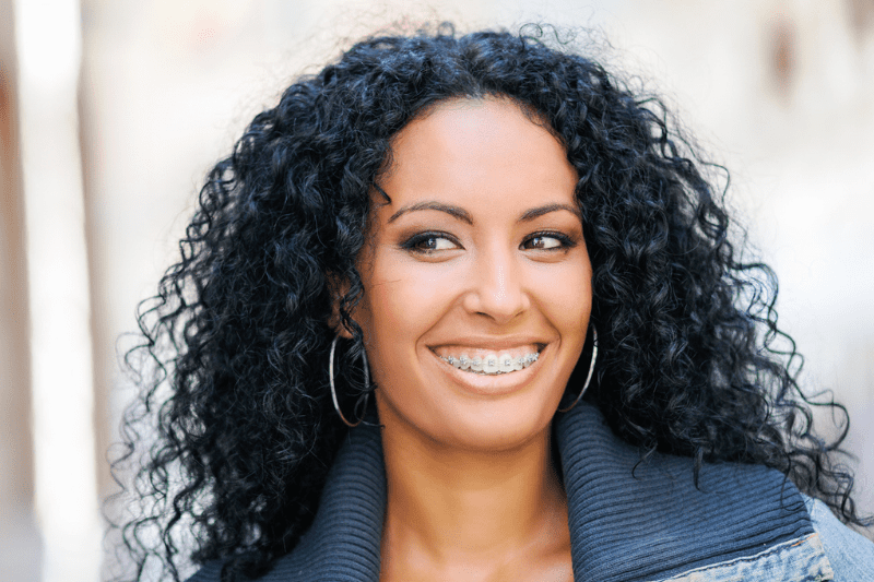 braces Wetherill Park cost adult orthodontic natural smile