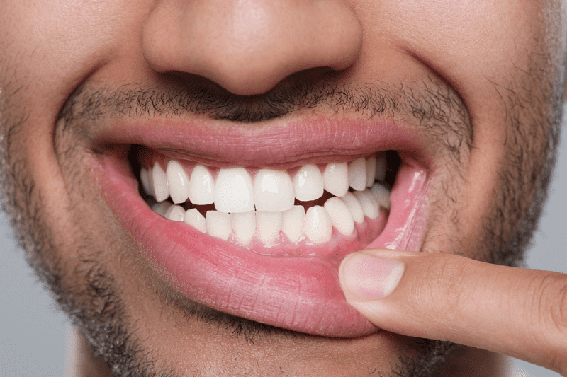 early gum disease causing loose tooth Wetherill Park