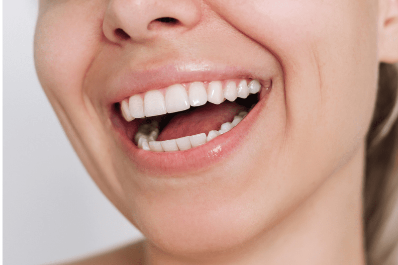 Natural tooth appearance after filling treatment in Wetherill Park