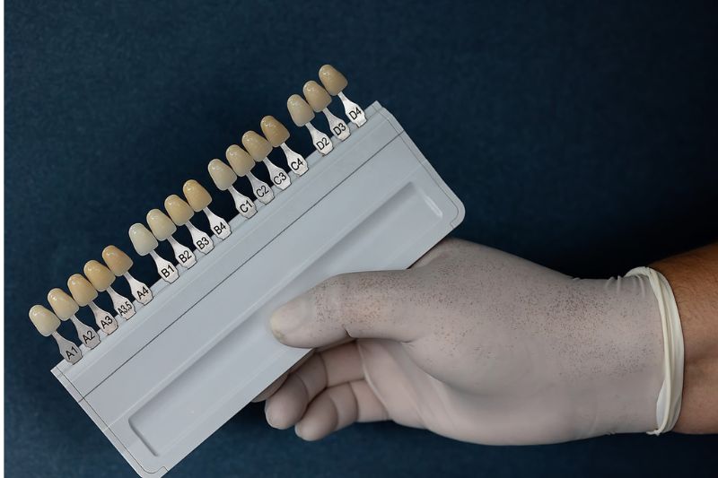 Veneers cost Wetherill Park dental shade guide used for colour selection
