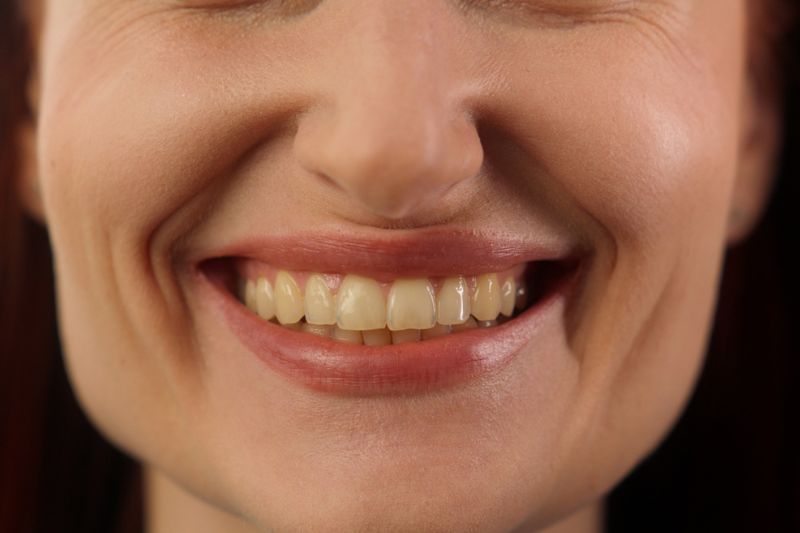 Why Are My Teeth Yellow in Wetherill Park? Causes and How to Fix It Safely