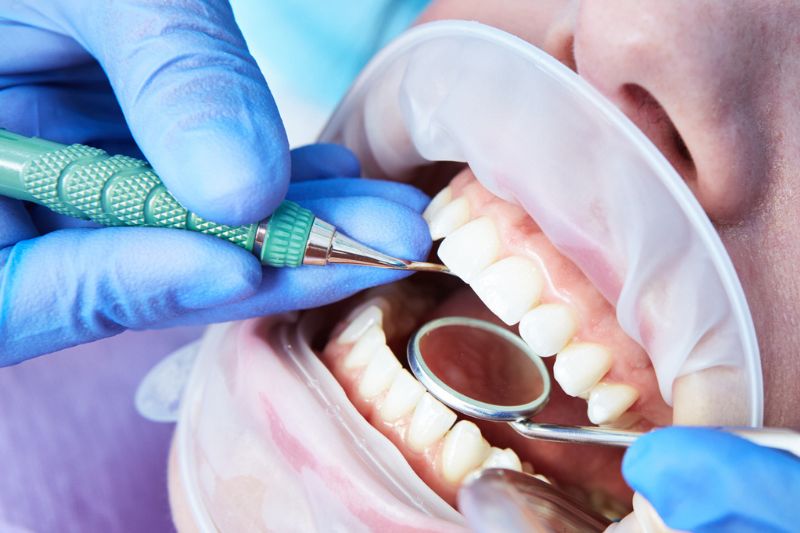 Can a Damaged Dental Crown Be Repaired or Does It Need Replacing in Wetherill Park?