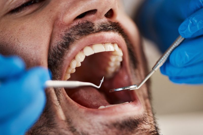 Dentist examining a patient's teeth after a missing tooth in Wetherill Park