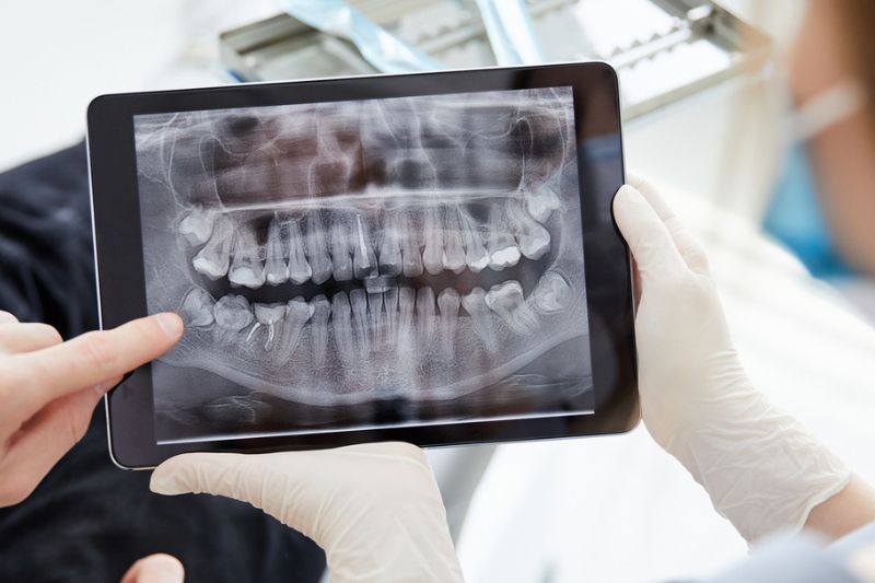 Dentist reviewing digital X-rays to assess a damaged dental crown in Wetherill Park.