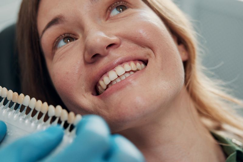 Dentist comparing veneer shades with a patient during a cosmetic dental consultation in Wetherill Park.