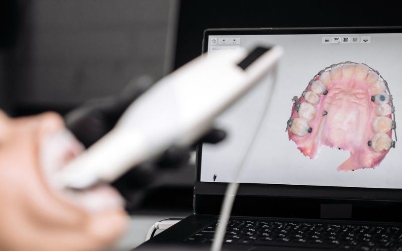 Digital dental scan used during orthodontic assessment and treatment planning