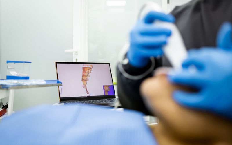 Digital orthodontic scan used to assess teeth shifting after braces
