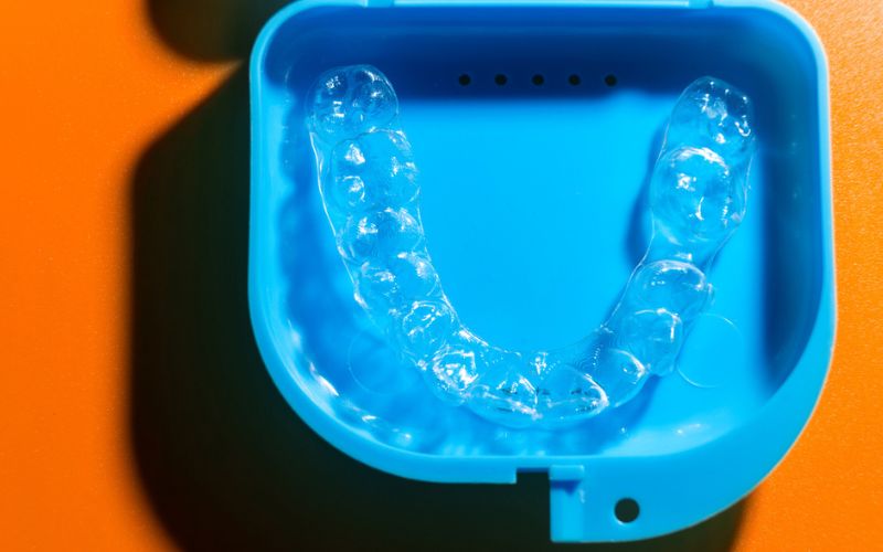 Clear removable retainer used to help maintain tooth alignment after braces